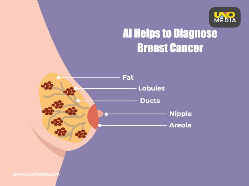 AI Could Help to Identify Breast Cancer